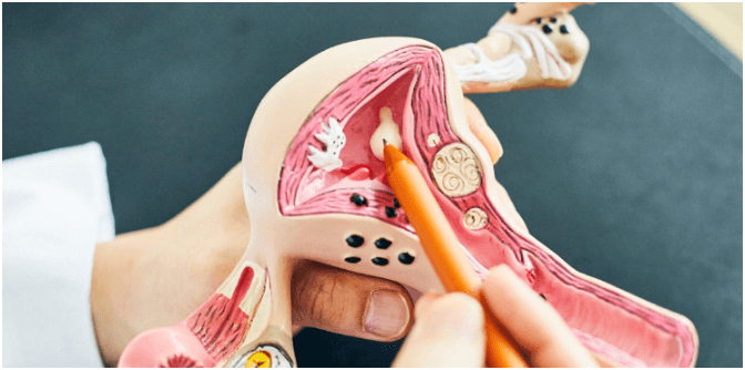 자궁선근증의 원인 증상 치료방법
