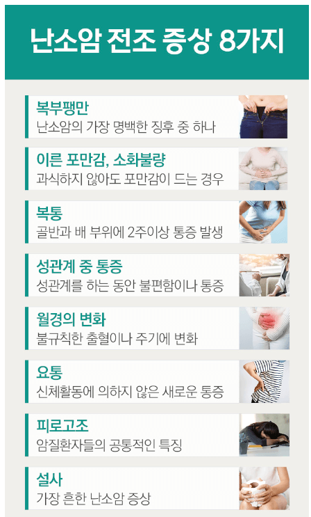 난소암의 원인 증상 치료방법